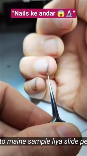 Dirty Nails Under Microscope 😱🔬" Hidden Bacteria.🦠🪱#microscope #nails #bacteria #ytshorts #shorts