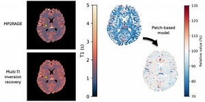 Comparison and calibration of MP2RAGE quantitative T1 values to multi-TI inversion recovery T1 values