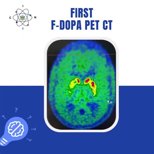 F-DOPA PET Now Available at Institut Caribéen d'Imagerie Nucléaire | Caribbean Institute of Nuclear Imaging (ICIN) posted on the topic | LinkedIn