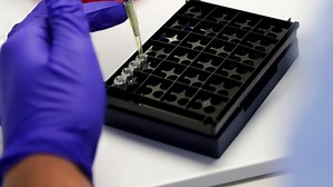 PCR por saliva: Cómo funcionará el nuevo examen tomado por el propio paciente