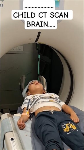 Pediatric CT scan brain #viral #ctscan #shortsfeed #shortviral #shorts #shortvideo #pediatrics