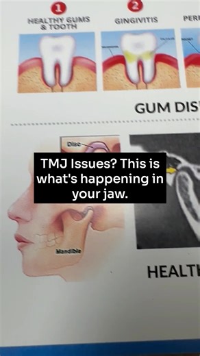 15K views · 75 reactions | Do you have TMJ issues? Constant jaw pain? Ringing in the ears? Dizziness or feel lightheaded all the time? Watch this reel as I explain what could be going on. Want to know for sure? Visit a holistic dentist and get a cone beam ct scan. If you haven't yet, check out my dentist directory to find one near you! #holisticdentist #tmj #jawpain #jawissues #lightheaded #dizziness #ringinginears #tinnitus | Living Well with Dr. Michelle Jorgensen | Facebook