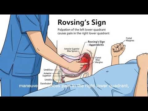 Rovsing’s sign #acute appendicitis#relaxing #health#medical