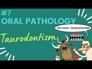 Taurodontism