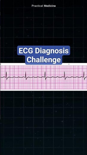 ECG test #ecg #ecgdiagnosis #ecginterpretation #ekg
