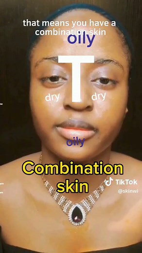 How to Identify Your Skin Type for Tailored Care