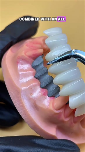 dentallab_Rock on Instagram: "Want to get a price list,please contact my WhatsApp: +86-15393729102, WhatsApp link: http://wa.me/8615393729102, our sale coworker will tell you more details, like brochure...#dentist#dentallab#teeth#denture #dentaltreatment #3Dprinter #Thefastest laboratory #crowns #Dentalimplant #Zirconiacrown #PFM #CAD #CAM"