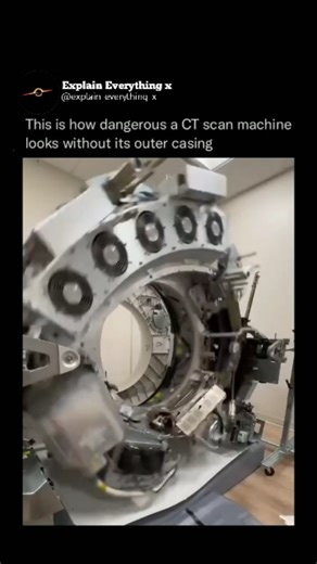 Explain Everything x on Instagram: "[3/100] 🎯 💢Follow please Follow (us) explain_everything_x to learn something NEW everyday Without its casing, a CT scan machine appears hazardous due to exposed high-voltage components, intricate internal mechanisms, potential radiation hazards, sharp edges, and moving parts. Its industrial look is much more intimidating compared to its usual smooth, sleek design. (Via: @arch_.irani) #didyouknow #history #reels #science #health"