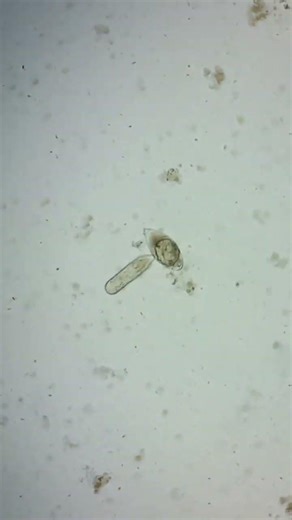 Life Cycle of Schistosoma haematobium (Miracidium Stage 2)