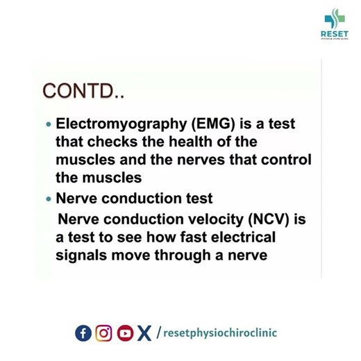 Bell’s Palsy Physiotherapy Treatment in Beeramguda | Facial Paralysis Recovery | RESET Clinic