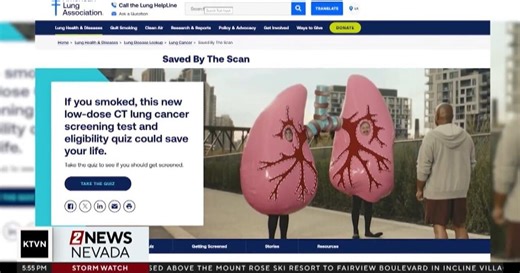 Health Watch: Early lung cancer detection