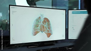 Computer Screens shows a Biotechnology software running. Biotechnology software is Analyzing the 3D Projection of the Patient`s Lungs. Biotechnology software has Identified Covid-19 Cells. Medicine.
