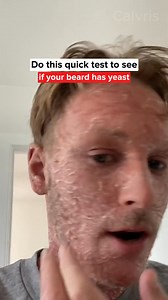 9.5K views · 384 reactions | Still scratching your beard? That’s not...