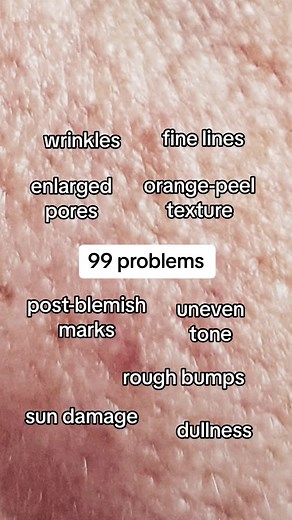 Clinical Niacinamide 20% Treatment for Enlarged Pores and Bumpy Texture