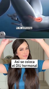 ¿Cómo se coloca el DIU?👩🏻‍⚕️ #diu #saludfemenina #mujer #medicina #datos #sabíasque #reelsfacebook | Dra. Paulina Zúñiga