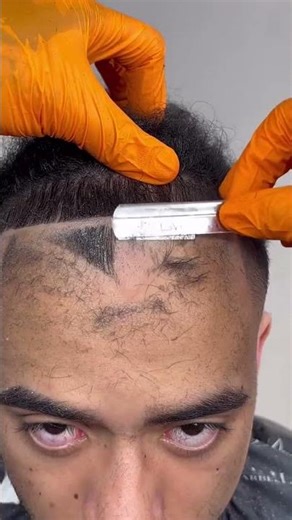Massive Hairline Restoration Fade Tutorial with Clippers #fade #barber #haircut