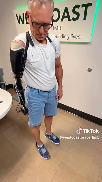 Inspiring Journey of Steven and His Transhumeral Prosthesis