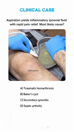 Clinical Case | Medical | Medicine | USMLE #medicine #usmle #medical #nursing #medicalstudent