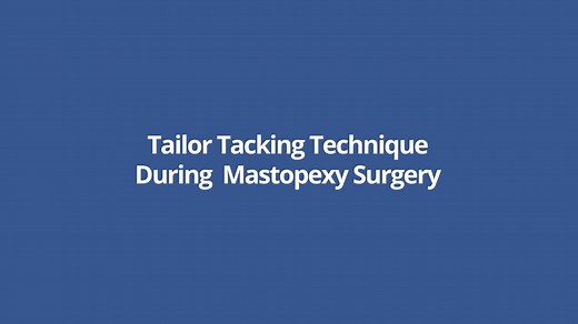 Tailor Tacking Technique During Mastopexy Surgery (GRAPHIC)