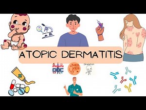 Atopic dermatitis - Eczema (Dermatology) | Medvidsmadesimple