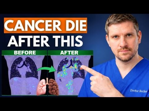 She Beat Cancer But Then THIS Happened To Her Body (Doctors Were Speechless)