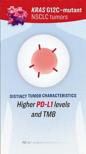 KRAS G12C distinct tumor characteristics