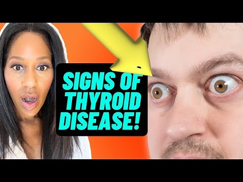 7 SIGNS OF THYROID DISEASE YOU CAN ACTUALLY SEE! A Doctor Explains