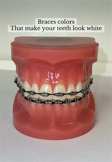 Braces Colors That Make Your Teeth Look White