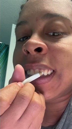 Trying Tooth Gems From #Aliexpress 💎