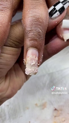 Acrylic Gel Overlay Tutorial - Natural Nail Care | Pretoria Nail Tech