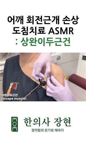 도침치료 ASMR : 상완이두근건 (어깨 회전근개 손상)
