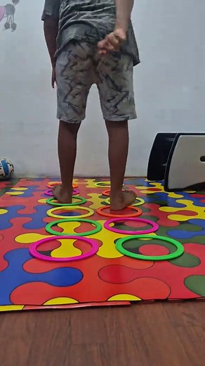 Understanding Femoral Anteversion in Orthopedics