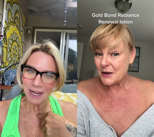 Gold Bond Crepe Corrector Before and After Pictures