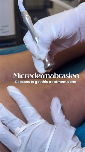 Luxskin By Dr Dineli on Instagram: "Microdermabrasion gently removes dead skin, clears pores, and reveals smoother, with zero downtime and instant glow. ✅ Removes dead skin cells ✅ Brightens dull, tired skin ✅ Smooths rough texture ✅ Clears clogged pores ✅ Helps reduce acne marks & pigmentation ✅ Improves skin tone and clarity ✅ Enhances absorption of skincare ✅ Instant glow with no downtime Safe for both face and body areas, this treatment keeps your skin fresh, clean, Book your glow session at