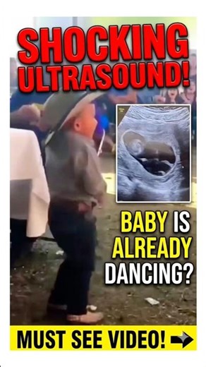 The World’s Youngest Dancer? This Ultrasound is INSANE! ❤️ Who's having a baby? 🙈🙈