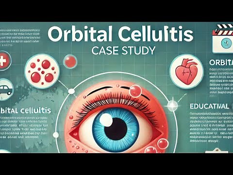 The eye and beyond: A Comprehensive Case Study of Orbital cellulitis | Expert Ophthalmology Insights