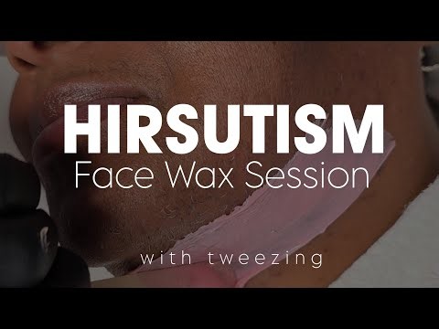 Full Face Wax with Tweezing! #Hirsutism #PCOS #PMOS #FacialWax
