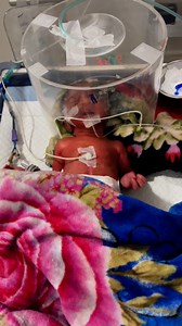 983K views · 81K reactions | Premature baby  #baby #prematurebaby #Premature #petloss #babyreels #temperature #newborn #kids #teammanagement | শিশুর যত্ন এবং স্বাস্থ্য পরামর্শ | Facebook