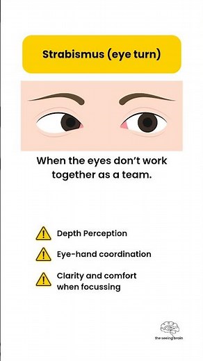 Down Syndrome and Eyes - #downsyndrome #eyehealth