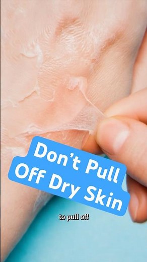 Why Your Skin Is Peeling