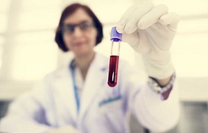 VSH Crescut: Cauze si Tratament