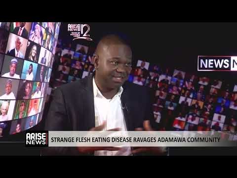Strange Flesh Eating Disease Ravages Adamawa Community -Olatunde