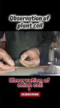 observation of onion cell | observation of plant cell