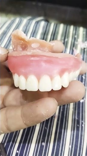 Teeth Arrangement Of Obturator aud upper Complete Denture 😁😁😁#obturator#dentures#softdenture#shorts