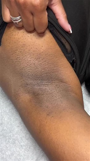 Waxing Queen Adventures on Instagram: "SHORT HAIR WAX CHALLENGE S3 activated with Plumeria by @blackcoralwax 😍🩷 #fyp #esthetician #viral #wax #challenge"