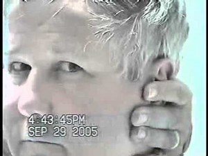 Abnormal Head Impulse Test