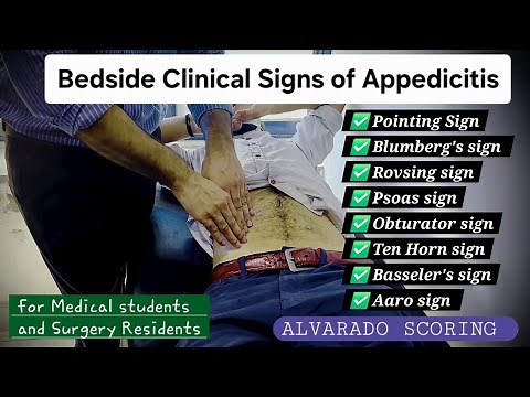 Clinical Signs of Appendicitis - Bedside Tests and their significance - Dr Tayyab Riaz Ch