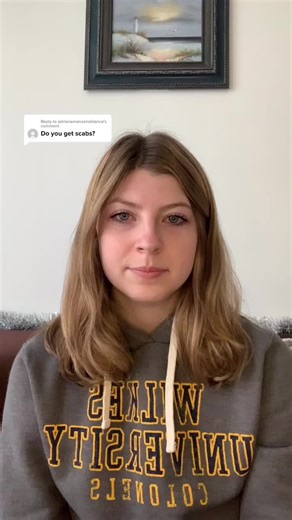 Illustrating my Skin Disorder Scabs | Dermatophagia Scars