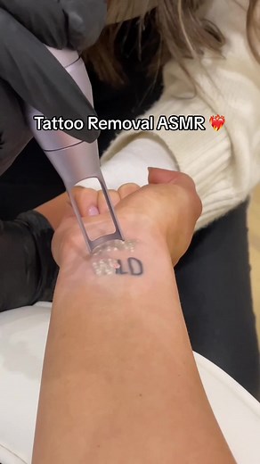 onlylaserskin on TikTok