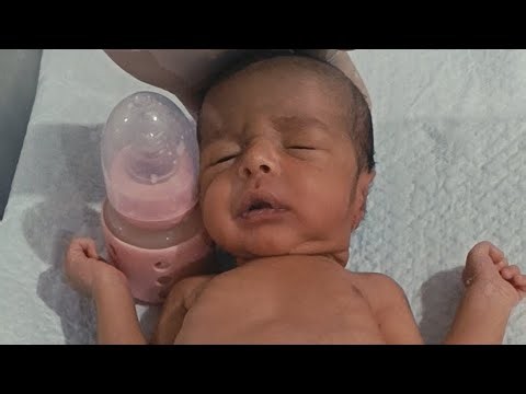 Bottle Feeding Procedure in a 5-Day-Old Newborn Baby with RDS (Recovery Stage NICU Care)
